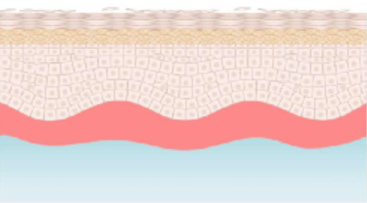 Grafico che mostra la sezione di pelle evidenziata dal colorante utilizzato nel test