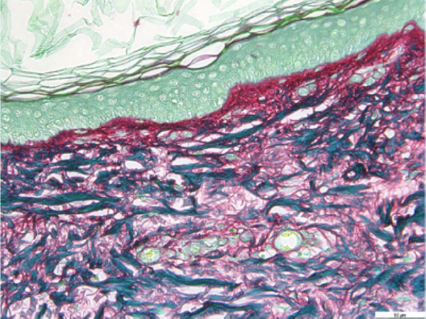 Immagine della sezione di pelle dopo l'applicazione di Liftable Exoserum, in cui si vede il collagene evidenziato con la colorazione Picrosirius Red (+26%)