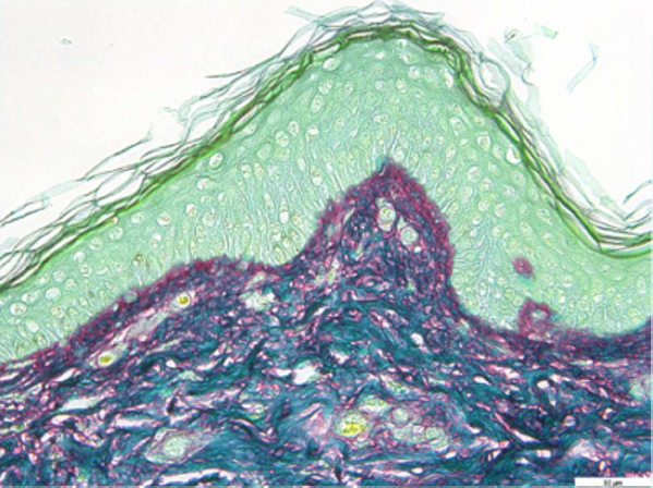 Immagine della sezione di pelle prima dell'applicazione di Liftable Exoserum, in cui si vede il collagene evidenziato con la colorazione Picrosirius Red