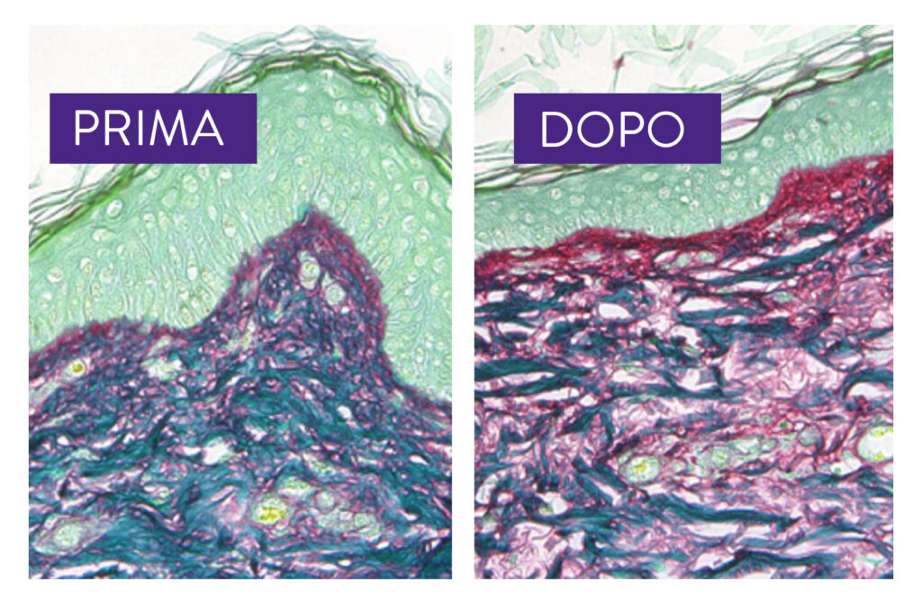 Liftable Exoserum: +26% collagene in 5 giorni*